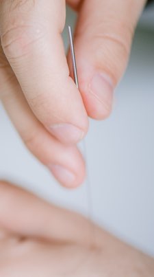 acupuncture-33